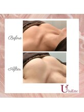 ウルエッテ(UluEtte)/福岡でバストアップならUluEtte