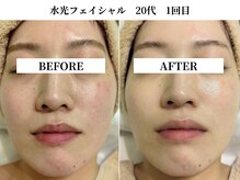 サンビ(SANBI)/大切なご予定前にも大人気！