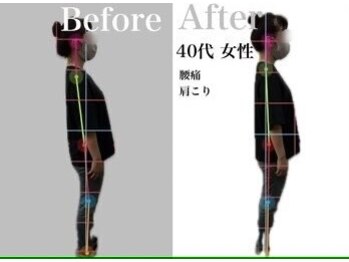 リスタート腰痛整体院 舟入院/症例7:40代女性　肩こり・腰痛