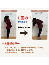 クローバー鍼灸整骨院/全身骨格矯正の一回の効果