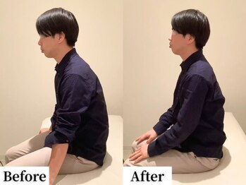 ソレア(Solea)/姿勢改善1回目 Before/After
