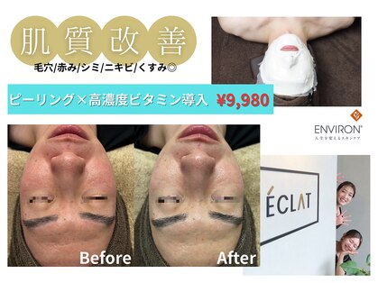 エクラ(ECLAT)の写真