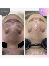 インフィニティ ビューティサロン 姫路店(INFINITY beautysalon)/-CHRISTINA-ビオフィート