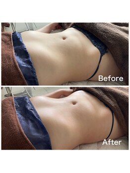 クリア(CLEAR)/リヴァイセルボディ