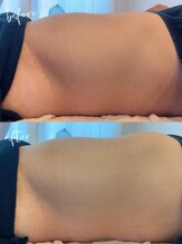 ルシェリアノーブル(le cherien noble)/男子も◎1回の効果！