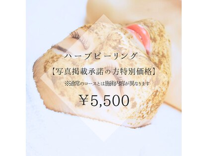 ラディア(Radia)の写真