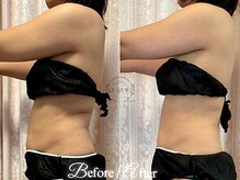 ラナンスパ(RANUN SPA)/お腹も背中もギュッとスッキリ！