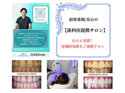 ホワイトニングショップ 妙高店(whiteningshop)の写真