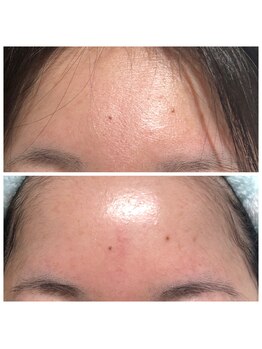 すっぴん美肌革命/艶と透明感あふれるおでこに