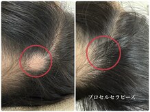 サラシック(salachic)の雰囲気（【新】プロセルセラピーズ頭皮ダメージ/男女問わずご相談下さい）