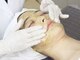 セレニティ バイ マリ(Serenity by Mari)の写真/【肌質改善におすすめ◎】輝く素肌へ導く、韓国式ピーリングで極上フェイシャル体験