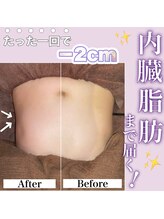 ミムー/before／after