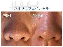 美シェリ(美Cheri)の雰囲気(名張・伊賀で唯一のハイドラフェイシャル正規導入店)