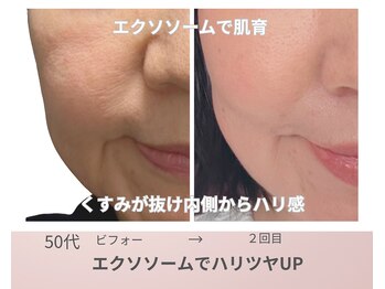 リアン(Lien)の写真/大人の乱れた肌構造を根本から整え年齢肌を再構築。弾むハリ・ツヤ・ボリュームを底上げする集中ケア。