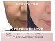 リアン(Lien)の写真/大人の乱れた肌構造を根本から整え年齢肌を再構築。弾むハリ・ツヤ・ボリュームを底上げする集中ケア。