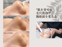 レイミー(reimee)の雰囲気（「今日綺麗にする」から「悩みを繰り返さない肌」へ【毛穴洗浄】）