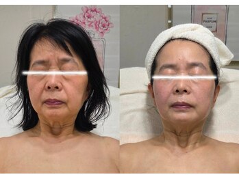 オレオマ(OLEOMA)の写真/【痛そうだけどいこうかな・・・】ちょっと待って！