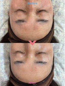 アウローラ(AVRORA)の写真/輝く肌へ。年齢に応じた悩み改善をサポートするフェイシャルと肌悩みのケアで美を追求★