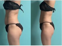 キノ(Kino)/体験に！ダイエット集中コース★