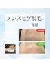 【メンズ脱毛】お顔（鼻から顎下まで）2,200円