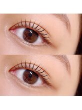 ノックス(NOCKS)/