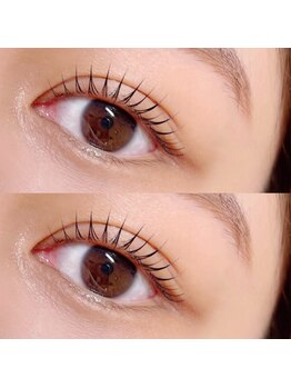 ノックス(NOCKS)/