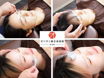 オリガミ鍼灸接骨院 旭丘院/小顔美容鍼×肌美容鍼