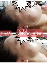 キアラ(CHIARA)/二重顎はどこへ？
