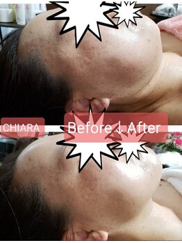 キアラ(CHIARA)/二重顎はどこへ？