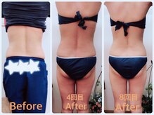 アーズ(A-Z)/【キャビゼロ痩身】お腹、腰回り