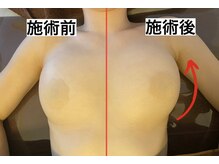 整顔整頭/【ふわふわボリュームUP】