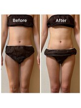 サロン ド クロエ(salon de Chloe)/Before→After（4回/月１）