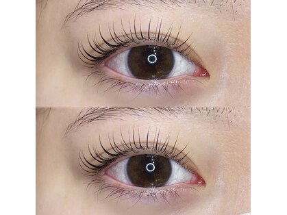 ロイヤルアイラッシュ(ROYAL eyelash)の写真