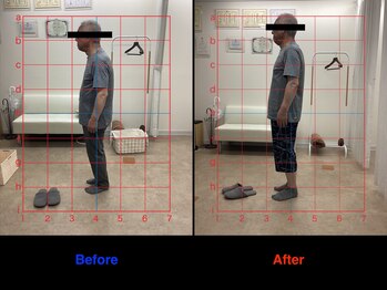 仁 久喜院(JIN)/#脊柱管#足の痺れ#シビレ#腰痛