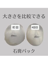 ミピマム/続ける度に小顔を実感