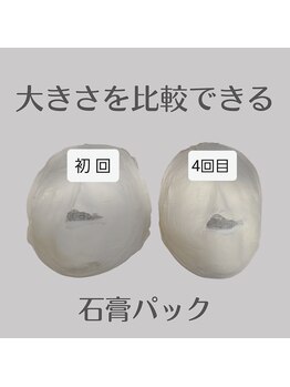 ミピマム/続ける度に小顔を実感