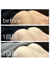 ドゥブレジャンティ(doubler gentil)/BeforeAfter