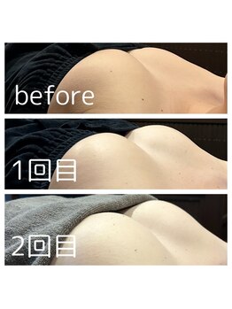 ドゥブレジャンティ(doubler gentil)/BeforeAfter