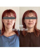 ウーマンビーヘルス(woman Be Health)/オーダーメイド美容鍼灸90分