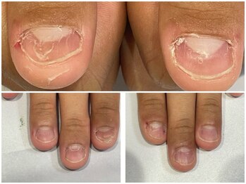 グレースレディ/コンプレックスもご相談ください