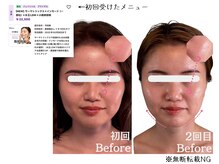 グロウズ(Glows)/