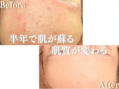 アクール(Accueil)の写真