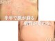 アクール(Accueil)の写真