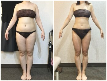 美容整体 ウェリナ 蟹江院/小顔矯正/骨盤矯正/美脚サロン