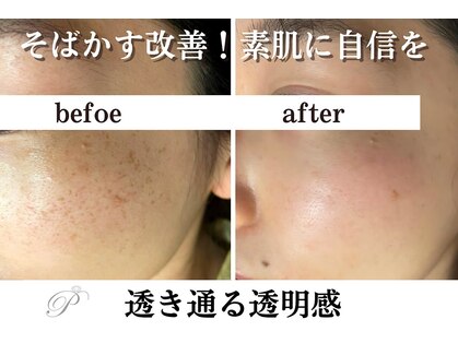 【シミケア/ハーブピーリング専門店】パールホワイトニングサロン　大船店の写真