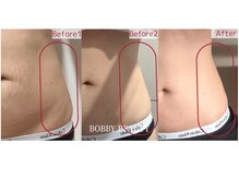 脱毛 痩身ぴゅあら/気になる部位をすっきり！！