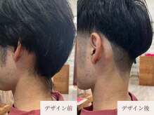 クラームビューティー(Clerm beauty)/美容師によるうなじデザイン脱毛