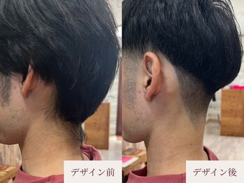 クラームビューティー(Clerm beauty)/美容師によるうなじデザイン脱毛
