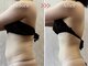 美容整体カラダリメイク(karada)の写真