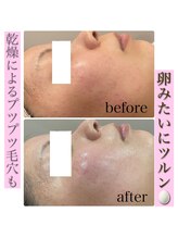 エミィシア(Emisia)/クリスティーナ・アンストレス